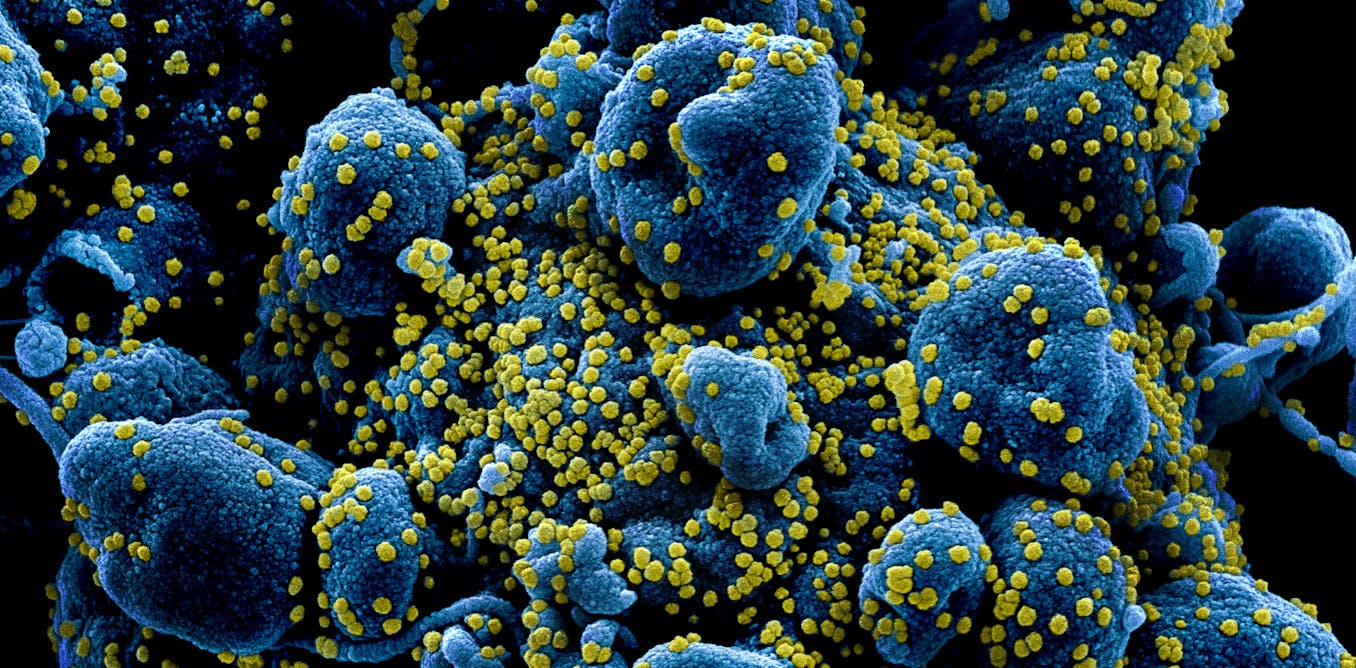 https://theconversation.com/el-coronavirus-y-la-fuerza-de-la-seleccion-natural-137525
