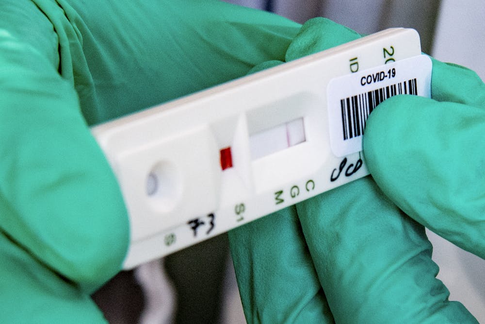 Rapid Home Based Coronavirus Tests Are Coming Together In Research Labs We Re Working On Analyzing Spit Using Advanced Crispr Gene Editing Techniques