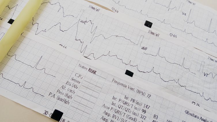 We designed an experimental AI tool to predict which COVID-19 patients are going to get the sickest