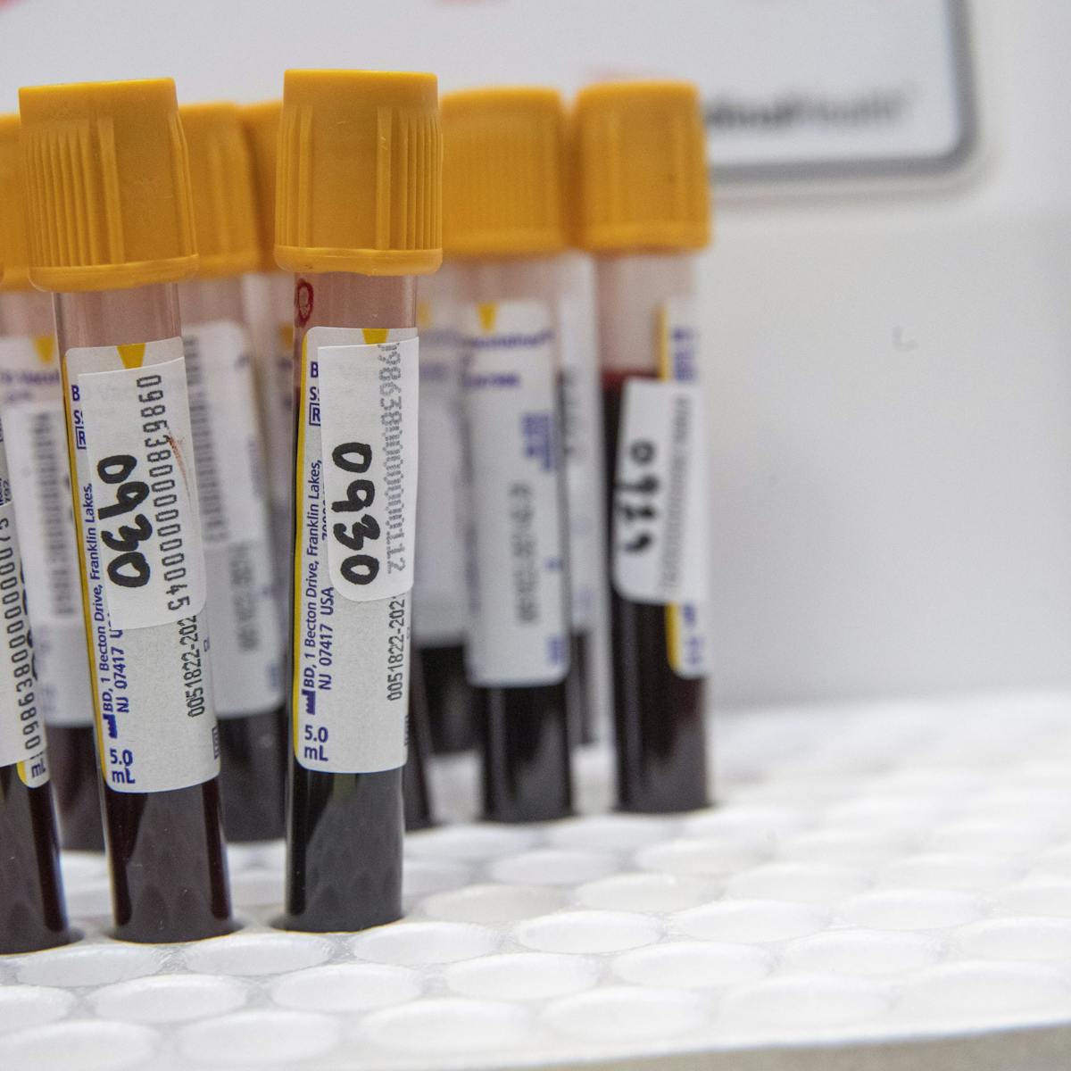 Can Antibody Tests Tell Us Who Is Immune To Covid 19