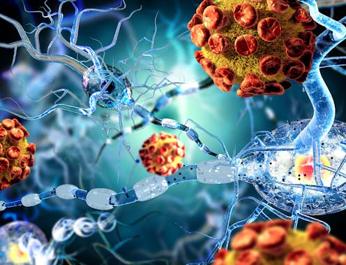 La actual pandemia de la COVID-19 ha colapsado los sistemas de salud pública hasta límites sin precedentes. Pero además de esta trágica amenaza para la salud, que se ha extendido por todo el planeta, se espera que sus consecuencias socioeconómicas sean dramáticas en todos los países. Ante este panorama y la falta de una vacuna efectiva, científicos de todo el mundo se afanan por buscar nuevas estrategias terapéuticas para mitigar las graves consecuencias derivadas de la “disfunción multiorgánica” en pacientes infectados por la COVID-19.