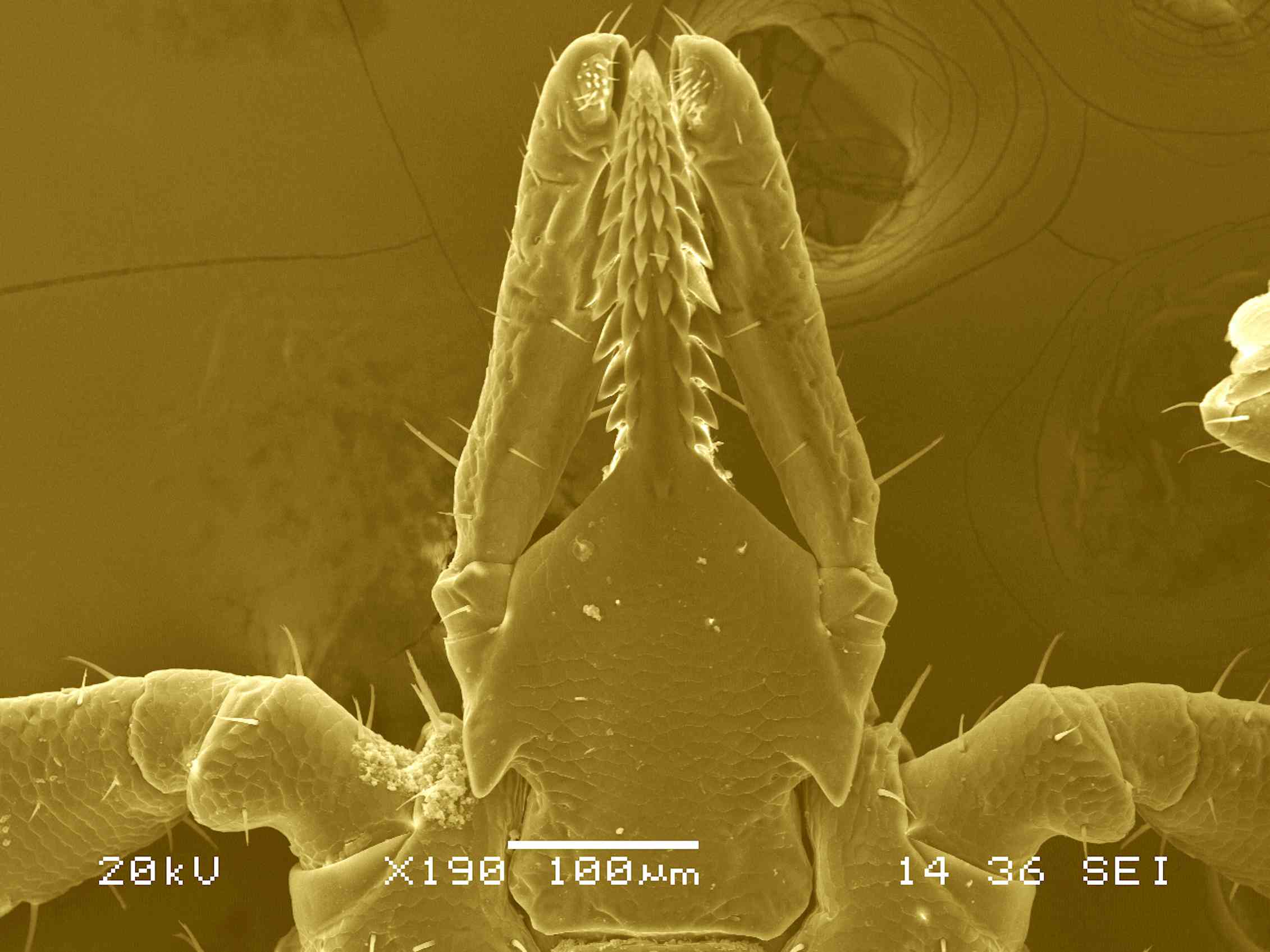 Энцефалитный клещ фото под микроскопом