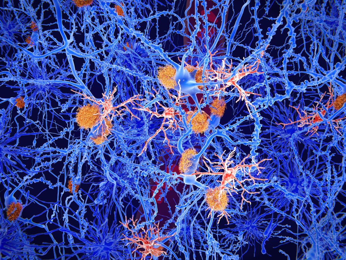 Microglia: the brain&#39;s &#39;immune cells&#39; protect against diseases – but they can also cause them