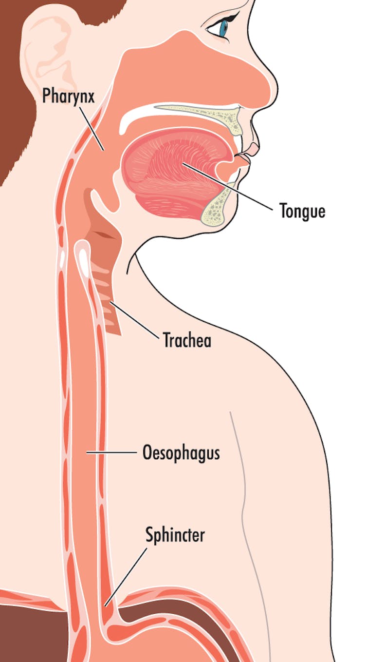 Curious Kids: why do we burp?