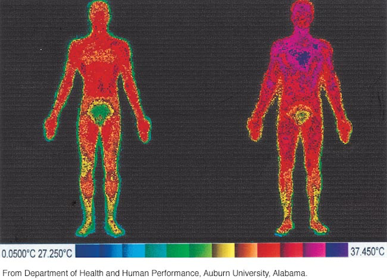 'Normal' human body temperature is a range around 98.6 F – a physiologist explains why