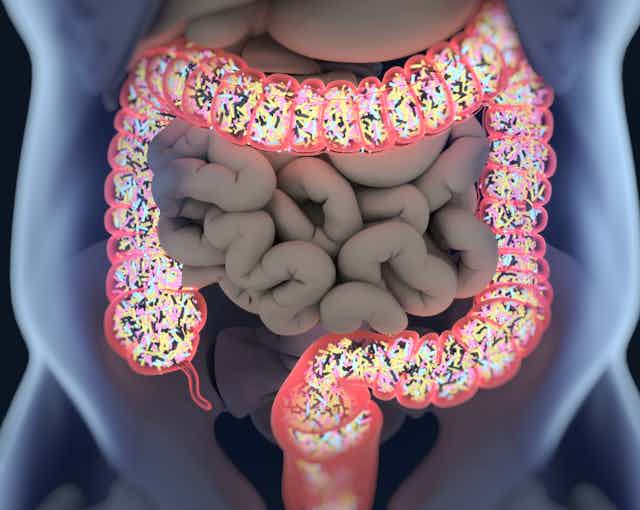Gut reaction: How the gut microbiome may influence the severity of COVID-19