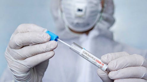 ¿Tendremos un otoño tranquilo? ¿Habrá una segunda oleada de COVID-19? Para intentar prever la evolución de la enfermedad se ha recurrido a comparaciones con la última gran pandemia, la gripe de 1918-19 provocada por el virus A-H1N1.