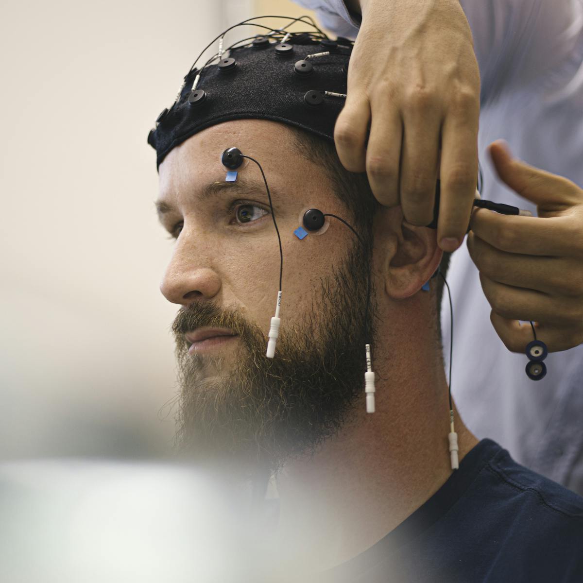 Coronavirus And The Brain Diagnosing And Treating Covid 19 S Neurological Effects
