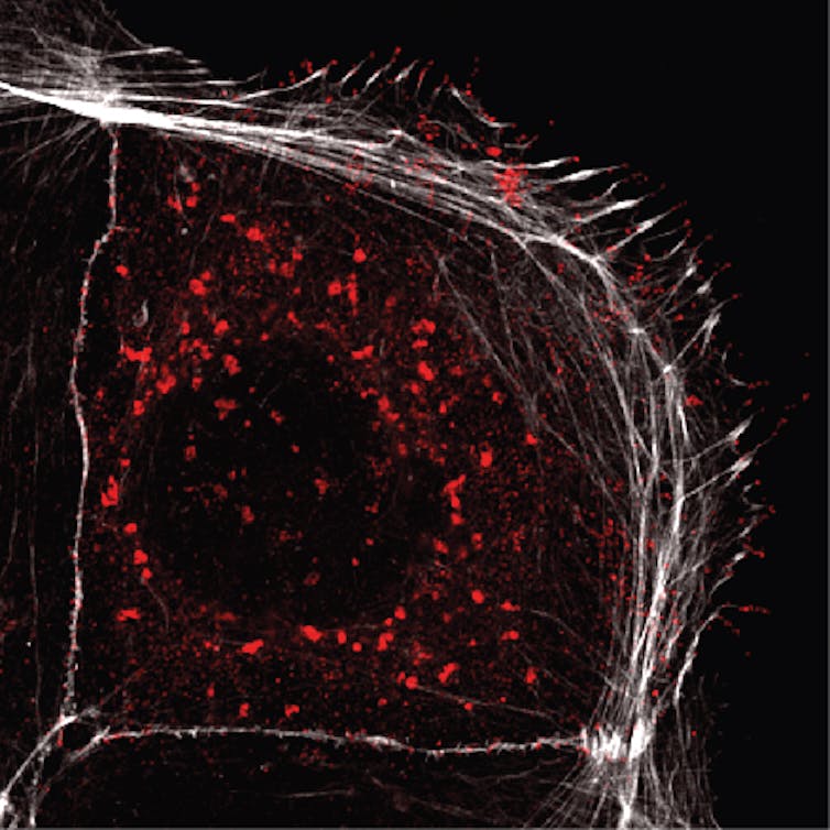 Coronavirus and cancer hijack the same parts in human cells to spread – and our team identified existing cancer drugs that could fight COVID-19