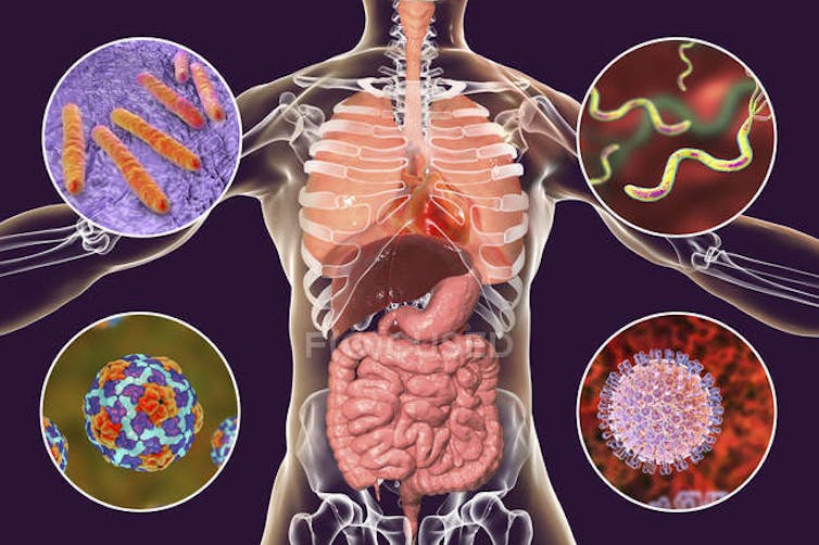 Síntomas gastrointestinais e cambios na flora asociados á Covid-19. Fonte: FAL.