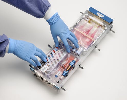 Why are scientists trying to manufacture organs in space?