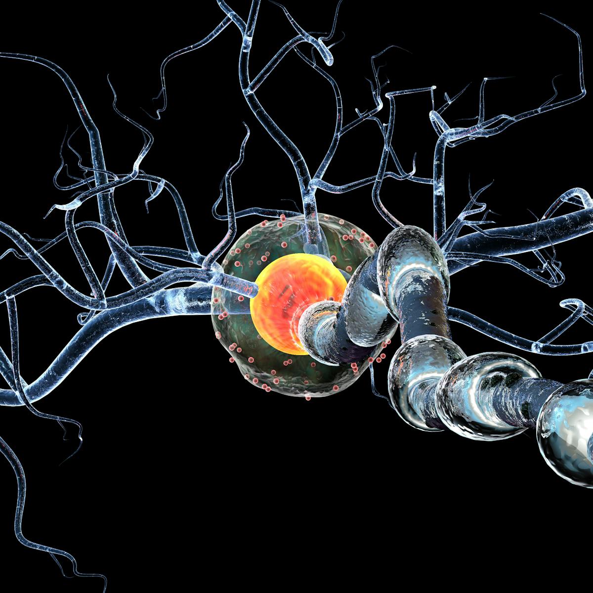 Rare Neurological Disorder Guillain Barre Syndrome Linked To Covid 19 Rare Neurological Disorder Guillain Barre Syndrome Linked To Covid 19