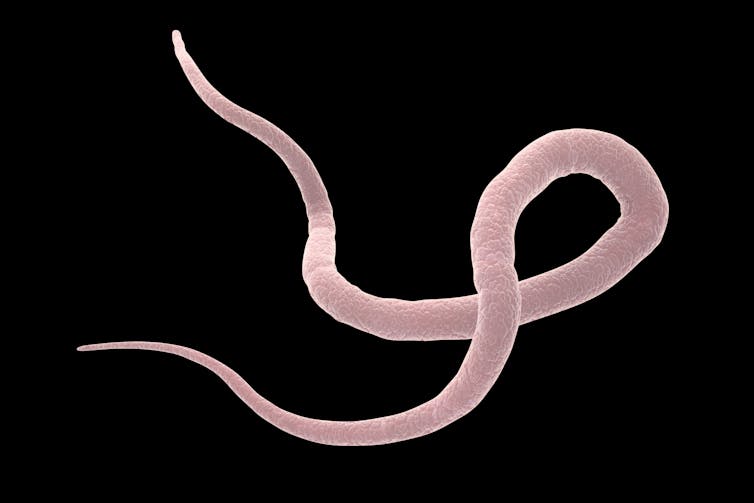parazit de tapeworm