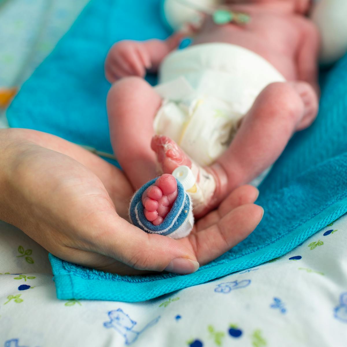 Las Consecuencias A Largo Plazo De Ser Un Bebe Prematuro Las Consecuencias A Largo Plazo De Ser Un Bebe Prematuro