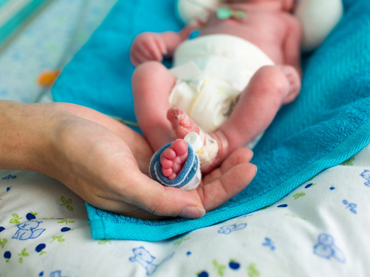 Las Consecuencias A Largo Plazo De Ser Un Bebe Prematuro