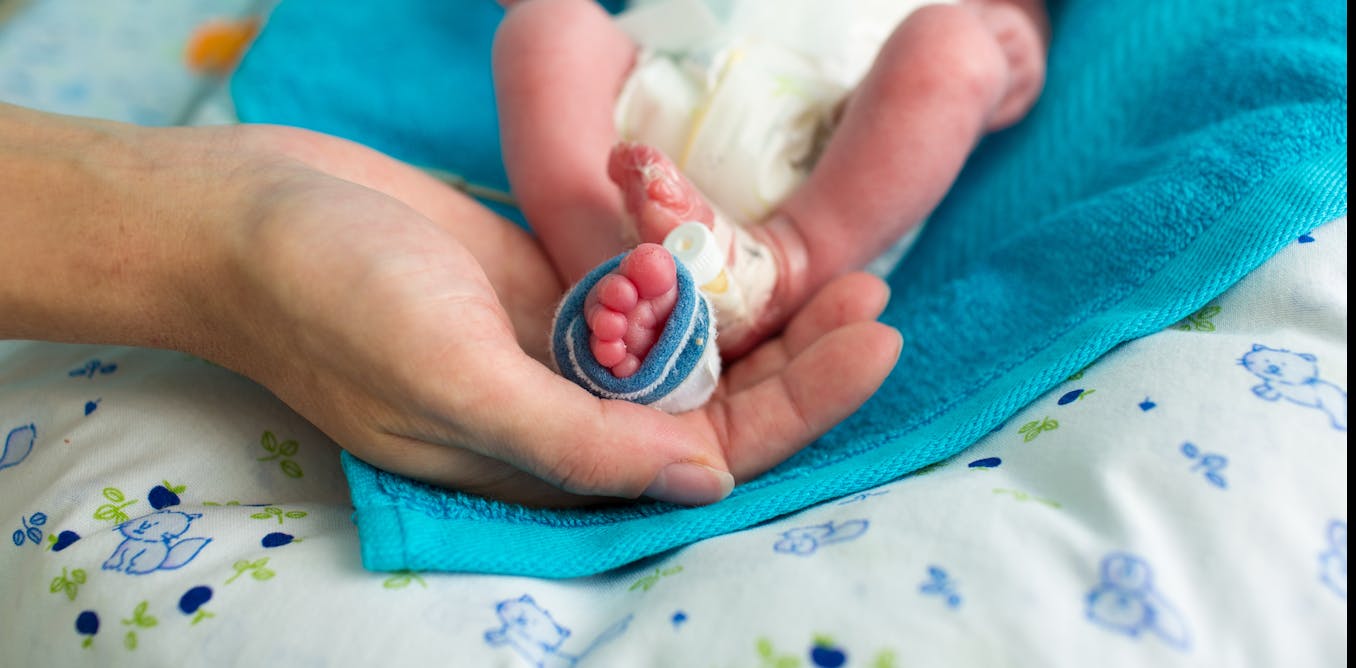 Las Consecuencias A Largo Plazo De Ser Un Bebe Prematuro Las Consecuencias A Largo Plazo De Ser Un Bebe Prematuro