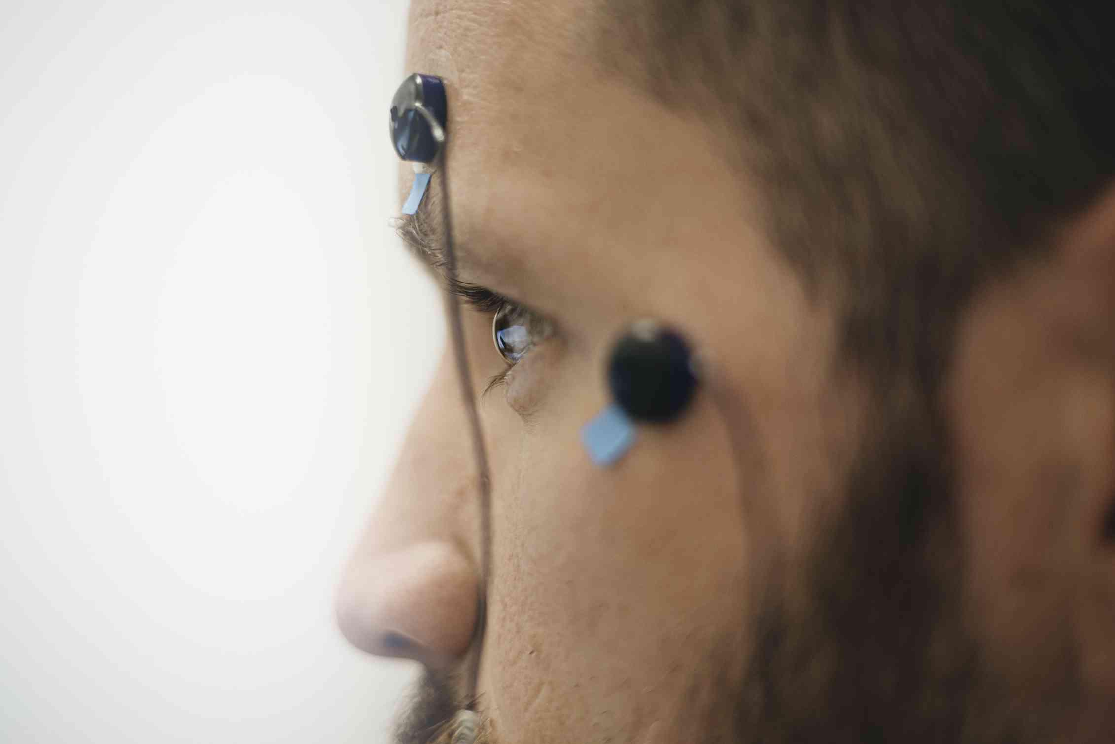 Closeup of a man's face in profile, with an electrode in place on his forehead and another beside his eye.