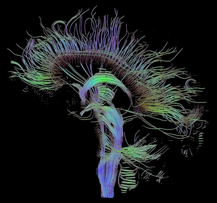 cerebro estructura más compleja