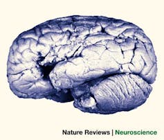 cerebro estructura más compleja