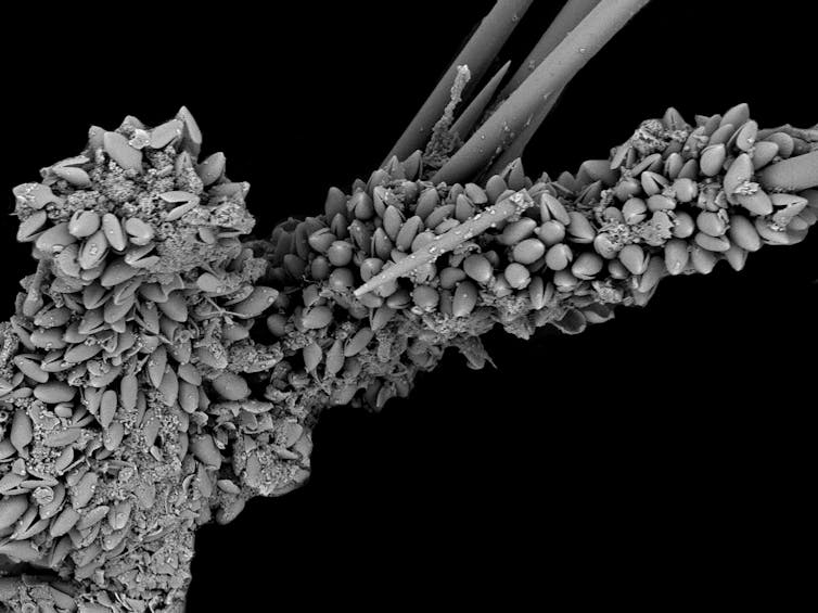 Sea sponge under a microscope