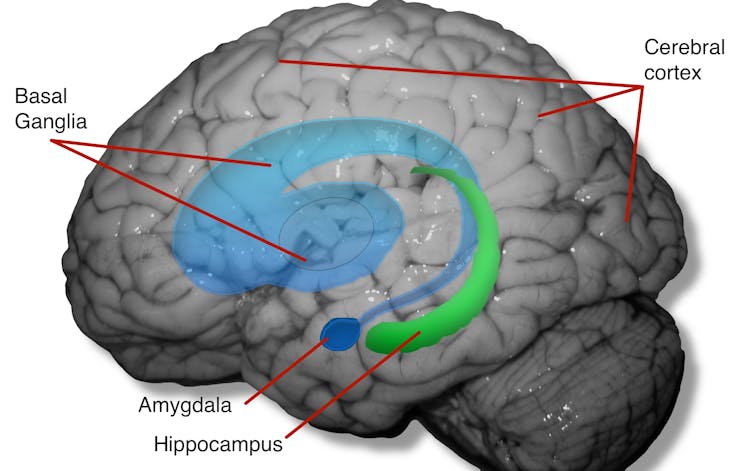 Image of brain showing areas affected by captivity