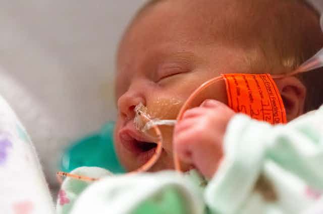 Sleeping baby in neonatal intensive care unit