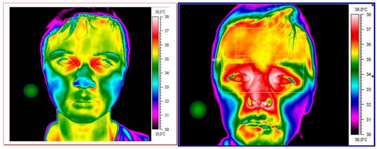 Two thermal images: one of a child without a fever and one of a child with a fever.