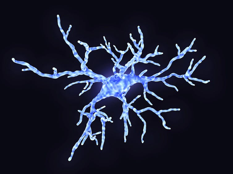 Image of neuroimmune cell-microglia