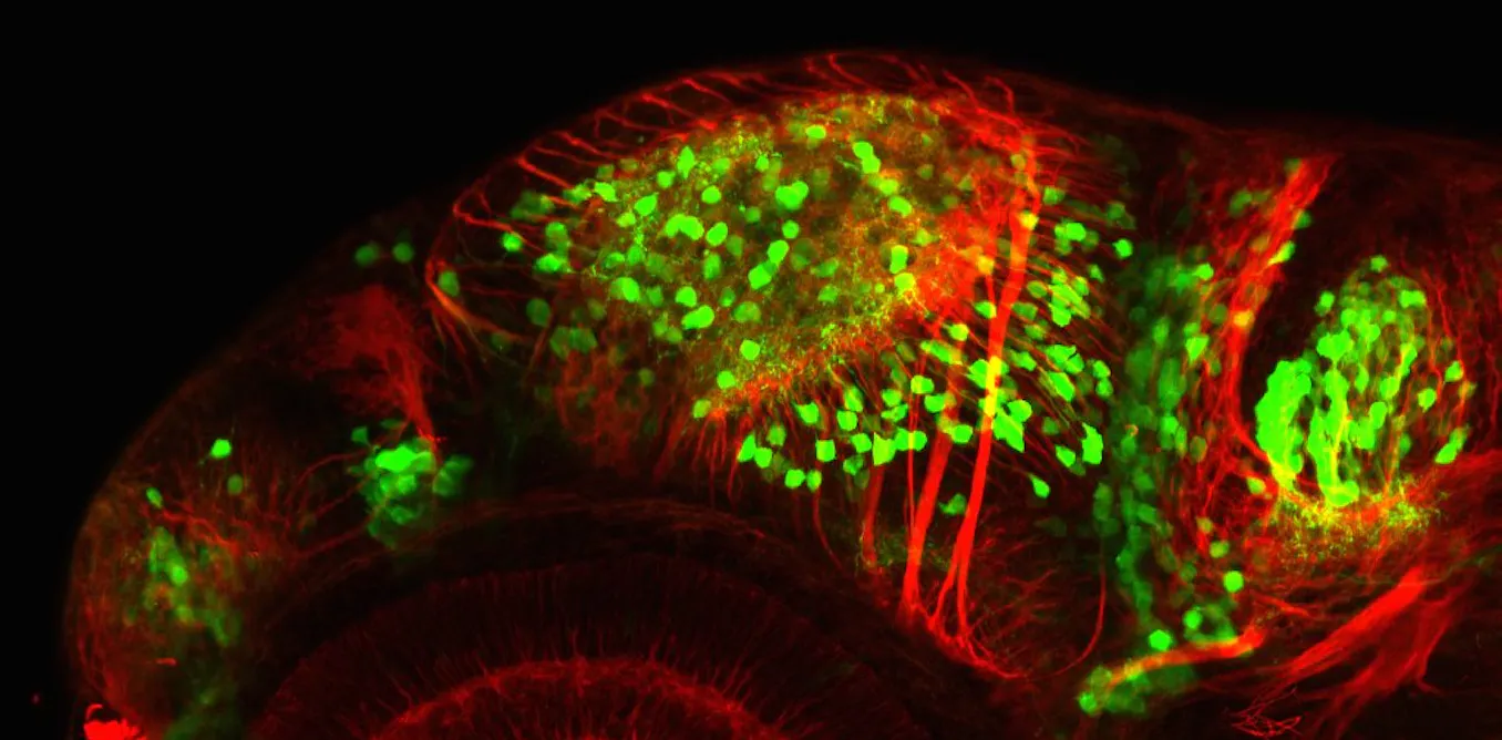 La proteína de medusa que hizo visible lo invisible