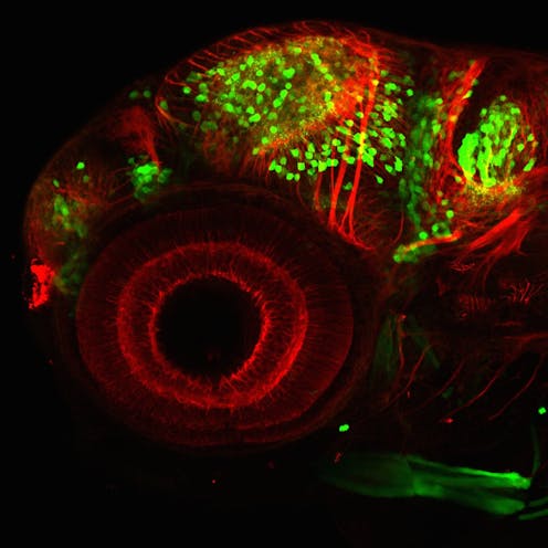 ¿Puede la proteína de una medusa permitirnos observar cómo se mueven células cancerosas? ¿O estudiar cómo se forma un órgano en un embrión? Parece poco probable, pero así es. La proteína verde fluorescente (GFP, por sus siglas en inglés) fue aislada de la medusa Aequorea victoria hace más de medio siglo y, con el tiempo, revolucionó el modo en que estudiamos células. Hizo visible mucho de lo hasta entonces invisible.