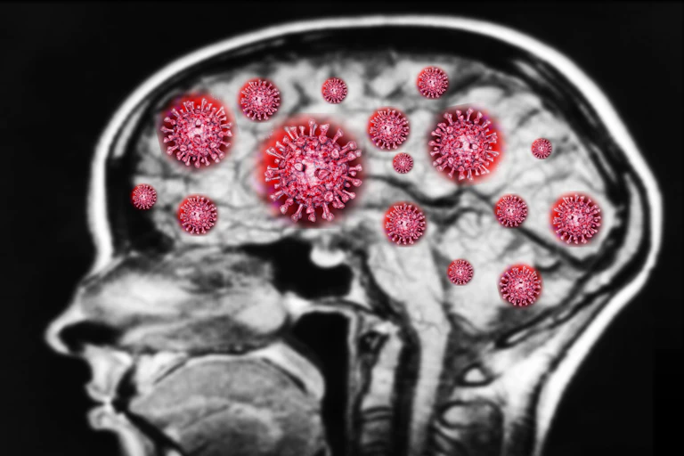 ilustración de una resonancia cerebral con dibujos de virus.