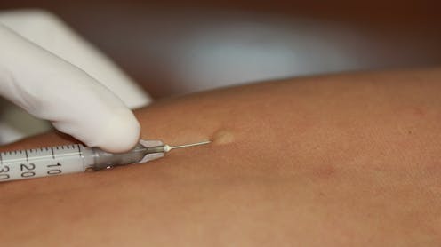 Sarpullidos, hinchazón, dificultades para respirar… ¿Conoce a alguien que haya sufrido estos síntomas tras tomar un medicamento? Quizá la primera idea antes de ir al médico sea pensar que se trata de una alergia. Sin embargo, debemos ser muy cautelosos: en realidad solo entre un 6 y un 10 % de los casos sospechosos son confirmados como una reacción alérgica al medicamento.