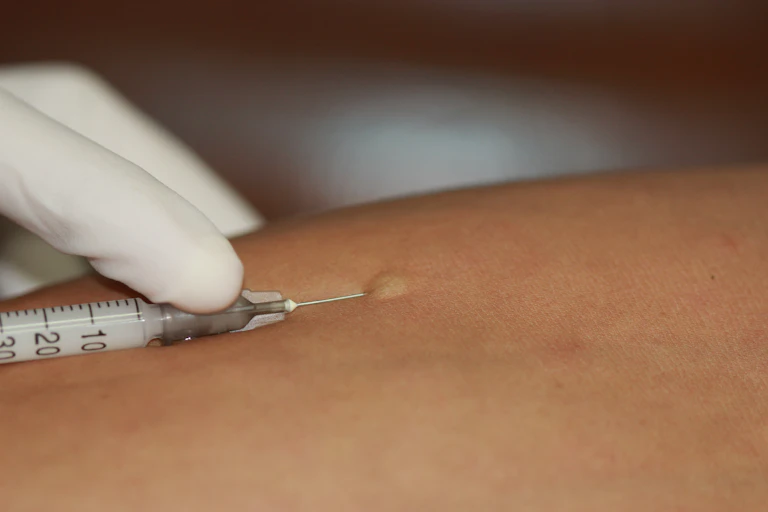 Aplicación de una aguja en un brazo.