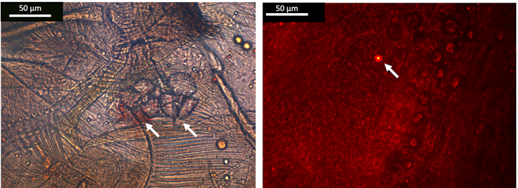 Fragmentos de microplásticos y nanoplásticos