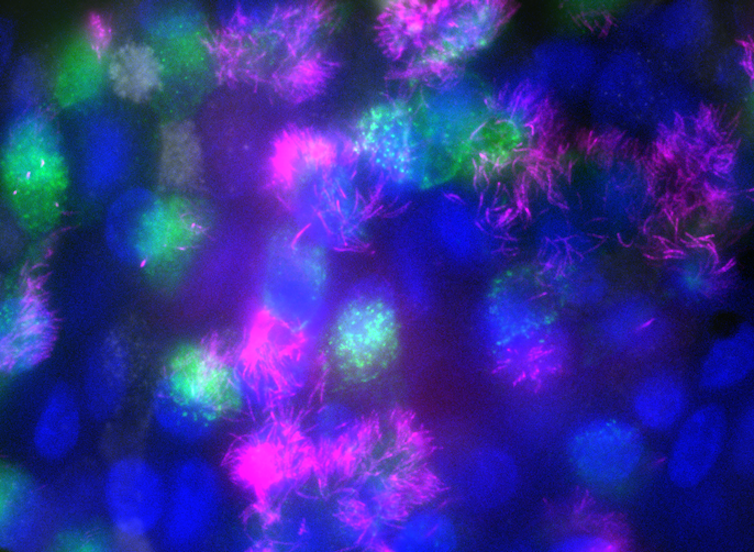 Immunofluorescence image showing lung hairs (pink), lung cell nuclei (blue) and virus particles (green).