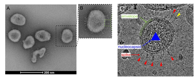 Electron microscopy visualisation of SARS-CoV-2 particles