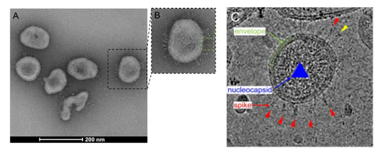 Electron microscopy visualisation of SARS-CoV-2 particles