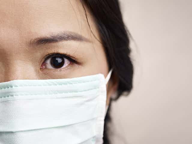 Close-up of the left side of a woman's face wearing a face mask. Her eye is bloodshot.