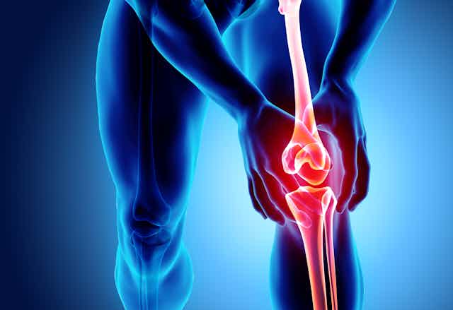 Graphic illustration of human knee joint