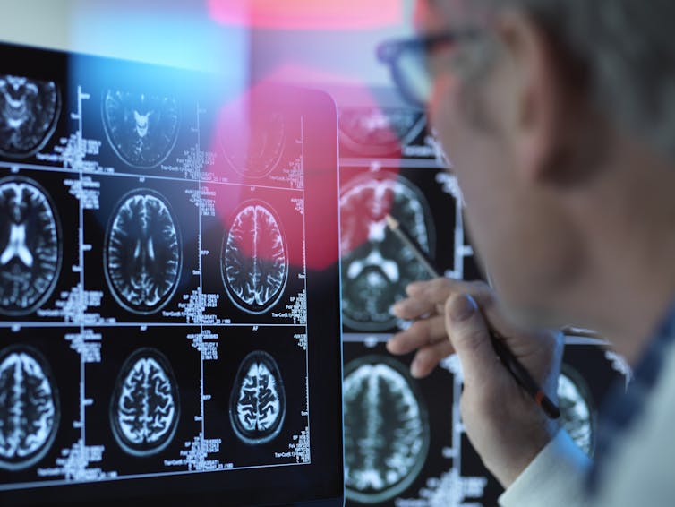 A doctor looks at images of a brain scan.