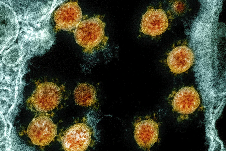 Electron microscope image of SARS-CoV-2 virus particles