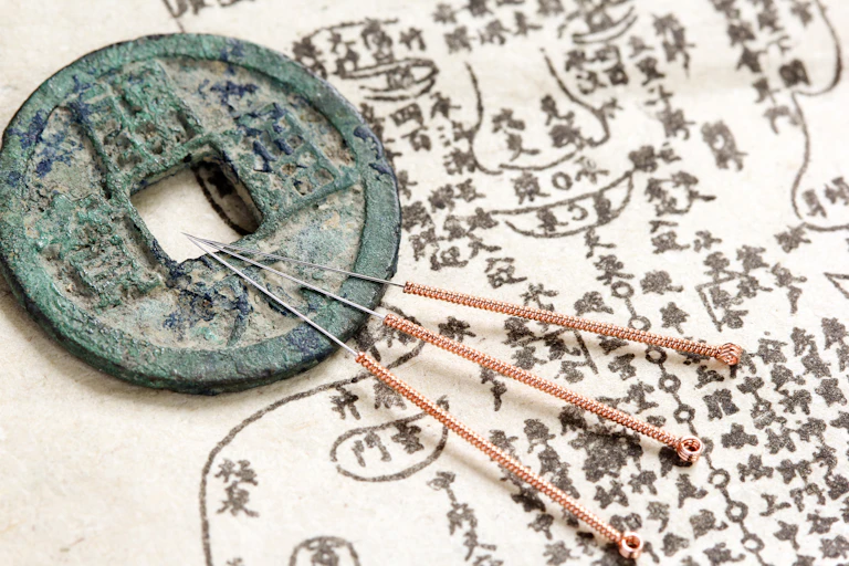 Acupuncture needles and ancient medicine illustration