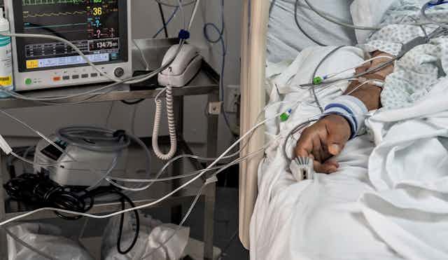 A COVID-19 patient in a Houston hospital in June 2020.