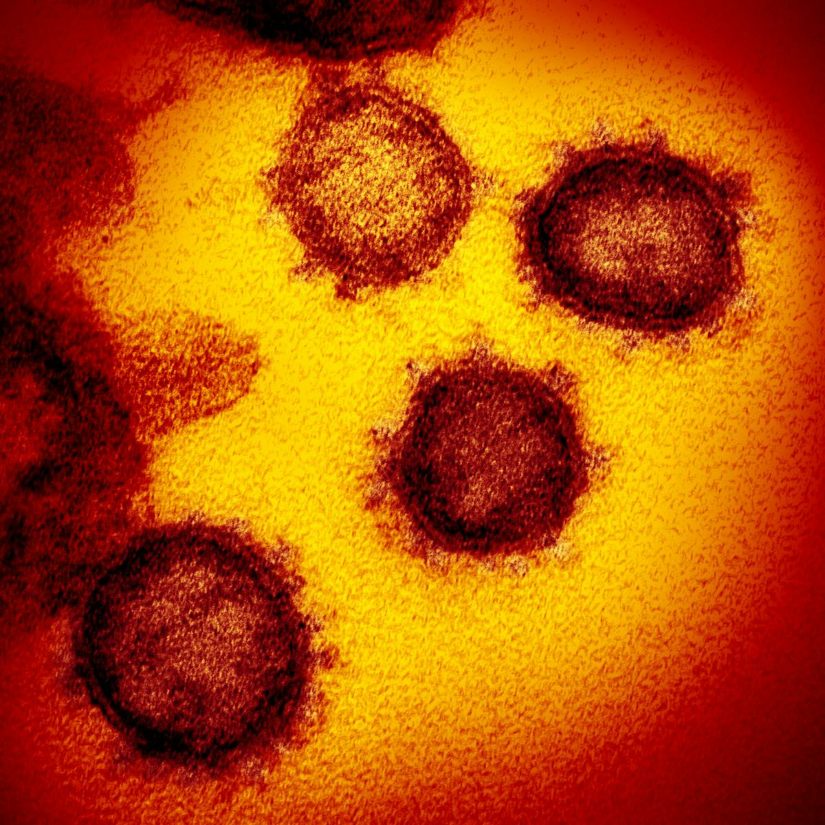 Mis C Is A Rare But Dangerous Illness Striking Children Weeks After They Get Covid 19 Here S What We Know About It