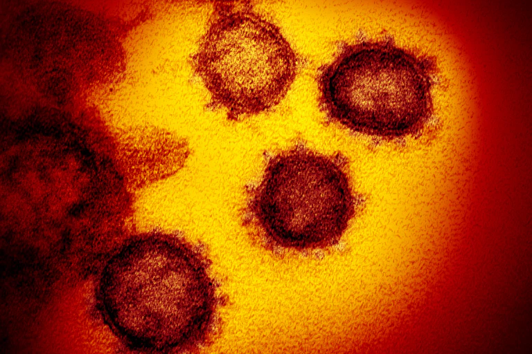 SARS-CoV-2 cells under an electron microscope.