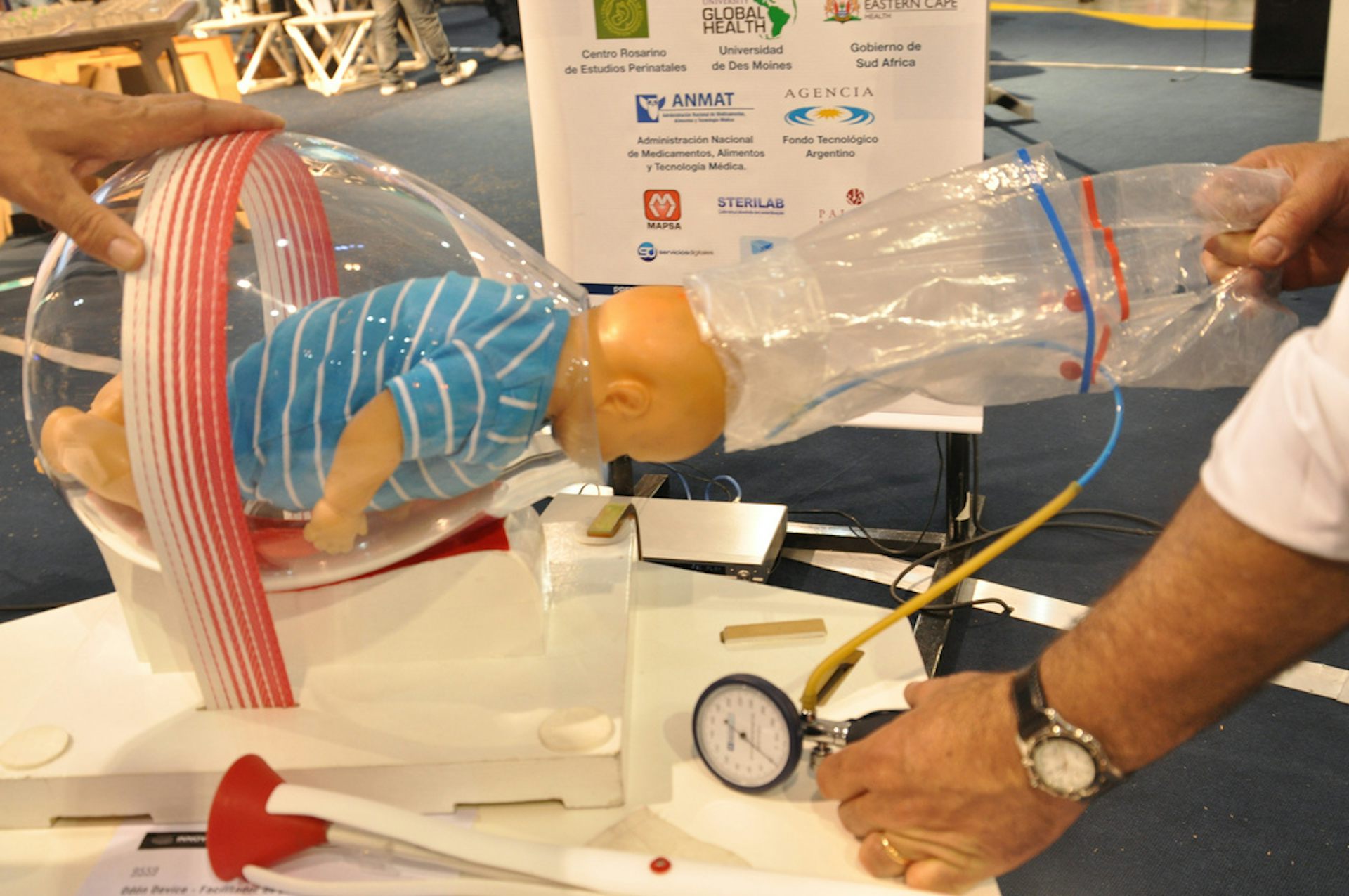 Vacuum Delivery Baby