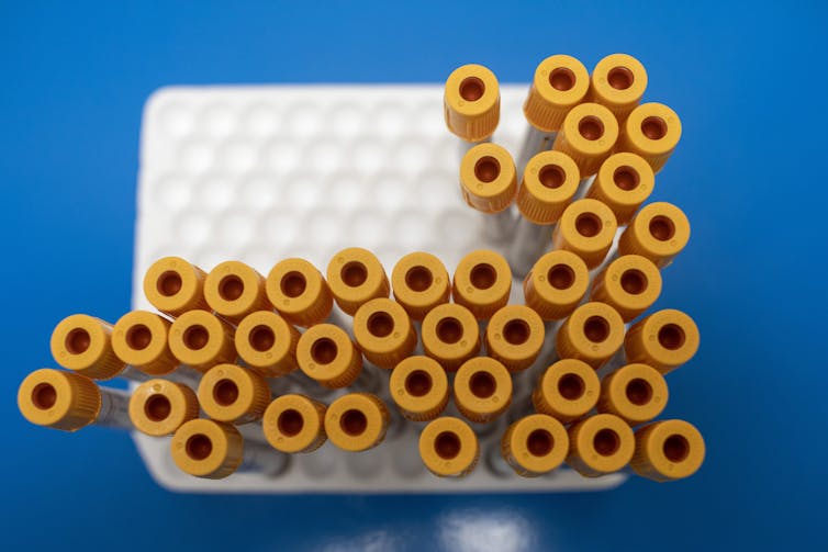 A collection of blood samples in test tubtes standing in a tray.