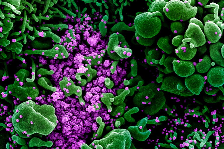 cellule infectée par le coronavirus SARS-CoV-2