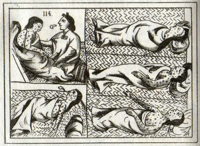 Drawing of Aztec smallpox victims