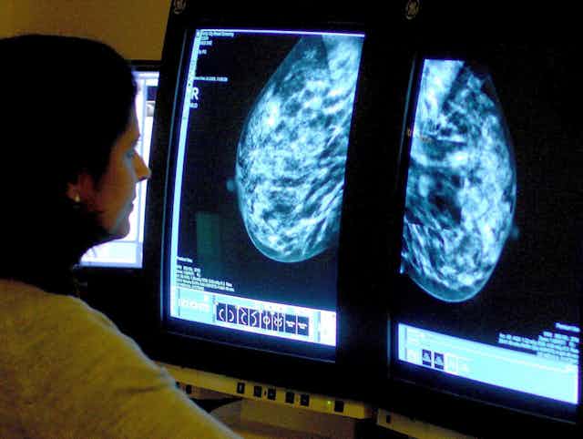 A woman looks at a medical scan on a screen.